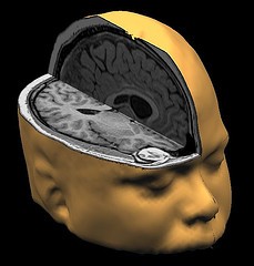 Your Brain on Drugs? Irish Cocaine Researchers Say - It's Very Different